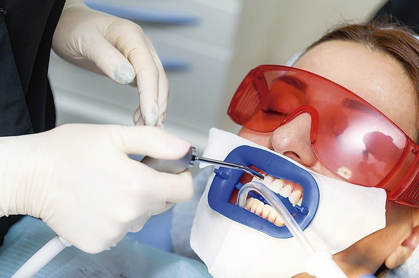 Blancorexia dental: qué es y cuáles son sus causas