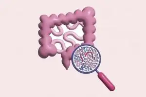 Sobrecrecimiento bacteriano en el intestino delgado
