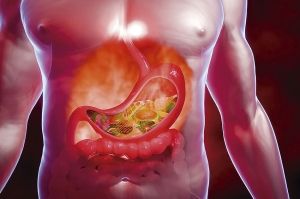 Reflujo gastroesofágico