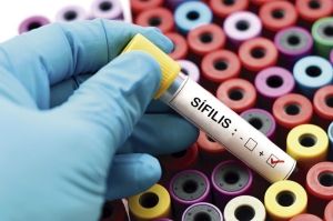 Sífilis, una enfermedad que preocupa