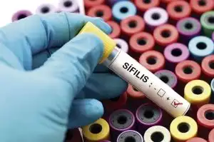 Sífilis, una enfermedad que preocupa