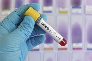 Qué es la listeriosis