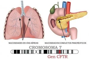 Fibrosis quística: la enfermedad genética que llegó al Congreso
