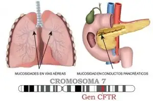 Fibrosis quística: la enfermedad genética que llegó al Congreso