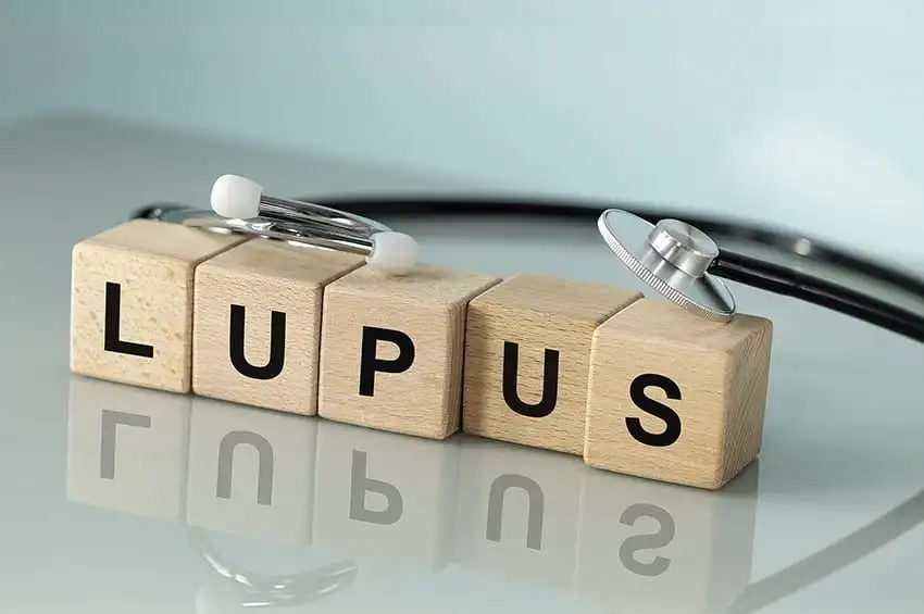 Afrontar la vida con lupus